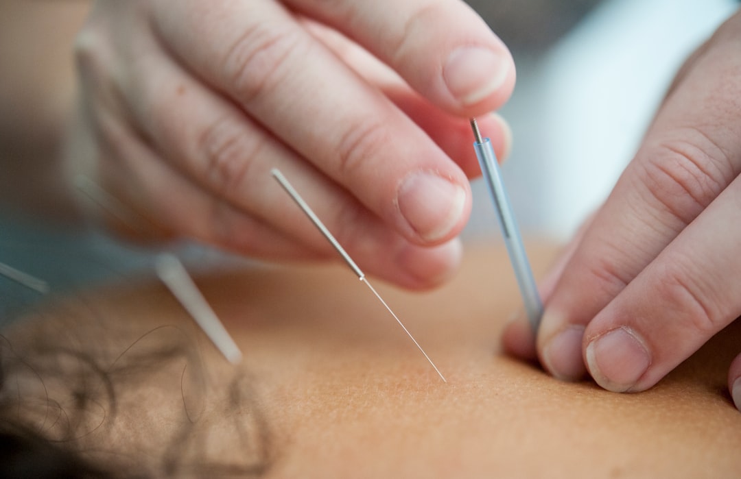 Targeting Chronic Sciatica and Lumbar Strain with Traditional Chinese Medicine